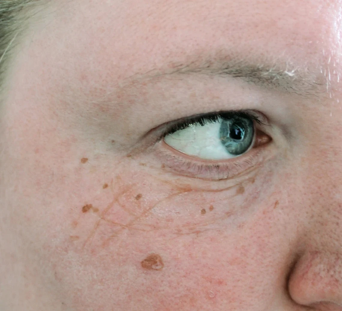 Jess FX - Moulds - Pair Of Old Age Eye Bag(Jess Fx Pair Of Old Age Eye Bag Moulds) 4 Jess FX - Moulds - Pair Of Old Age Eye Bag(Jess Fx Pair Of Old Age Eye Bag Moulds) - Image 2