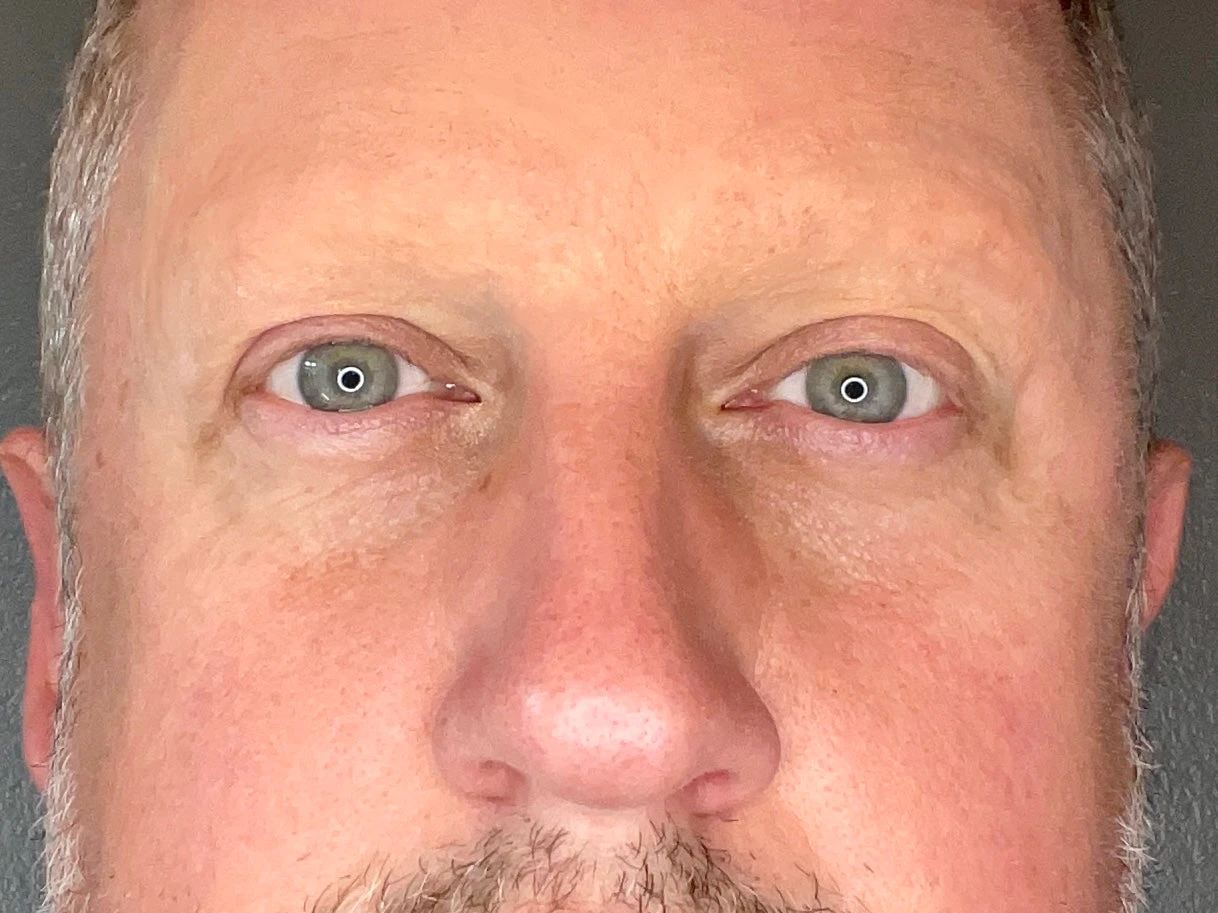 Ripped From The Crypt - Set 9 - Brow Blockers (Moulds)(Ripped From The Crypt Set 9 Brow Blockers Moulds) 4 Ripped From The Crypt - Set 9 - Brow Blockers (Moulds)(Ripped From The Crypt Set 9 Brow Blockers Moulds) - Image 2