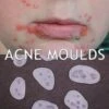 Jess FX - Moulds - Acne(Jess Fx Acne Moulds) 2 Jess FX - Moulds - Acne(Jess Fx Acne Moulds) -TILT Makeup https i.etsystatic.com 18592277 r il ec9432 4393152690 il fullxfull.4393152690 cqwe