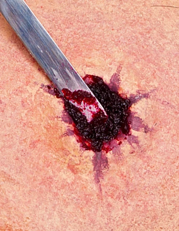 Kryolan WOUNDFILLER(Kryolan Woundfiller) 4 Kryolan WOUNDFILLER(Kryolan Woundfiller) - Image 2